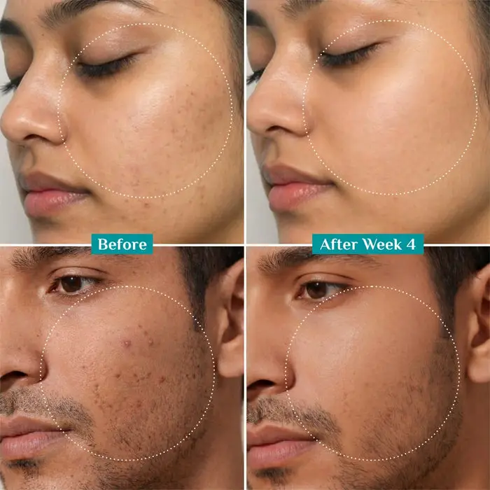10% Niacinamide Face Serum With Kojic Acid & Korean Rice Water Discover Clear Glass Skin Glow